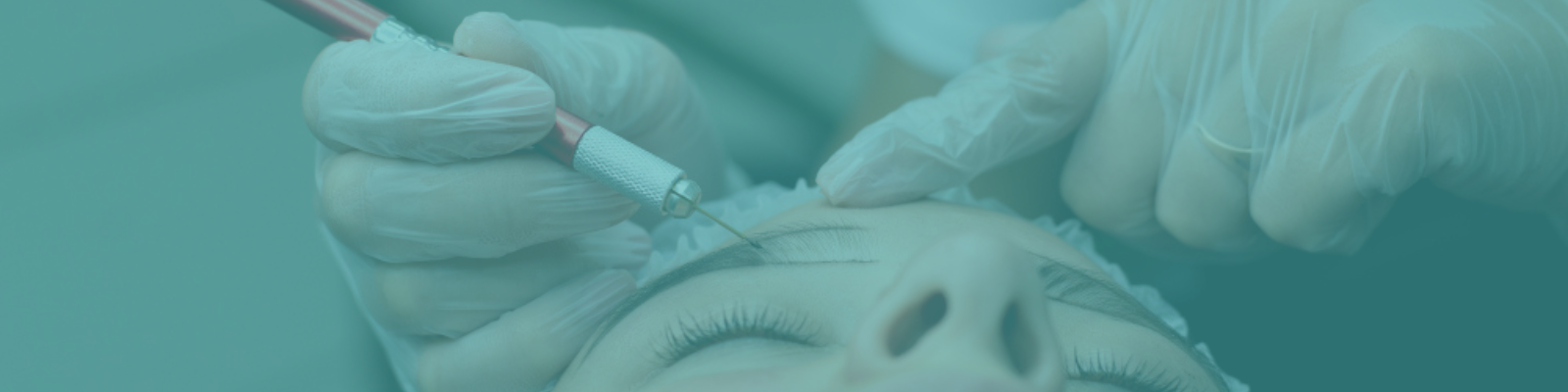 Greffe de sourcils